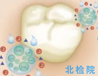 牙科氟化物檢測(cè)