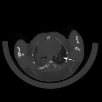 Kras-(LSL-G12D)-1.png