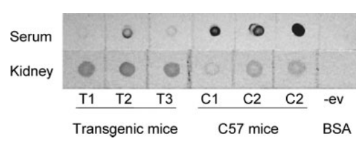 HBV-4.png